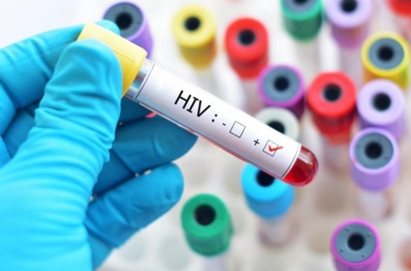 Cố ý lây truyền hiv cho người khác