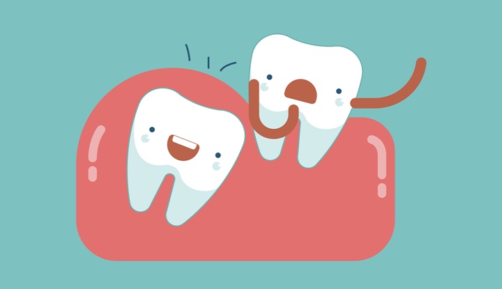 Bảo hiểm y tế có chi trả khi nhổ răng khôn không