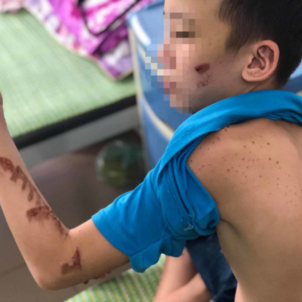 Hậu quả của bạo hành trẻ em