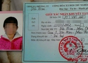 Mức độ khuyết tật nào được hưởng trợ cấp