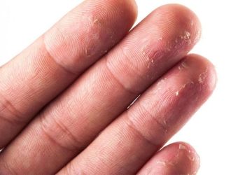 Làm thẻ CCCD gắn chip mà mất dấu vân tay phải làm sao?